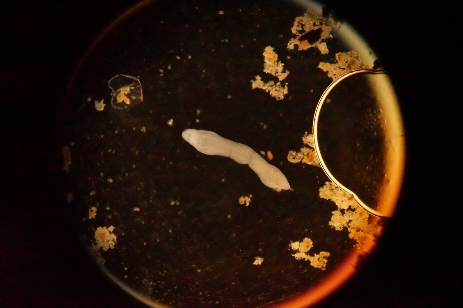 Flatworm under darkfield illumination