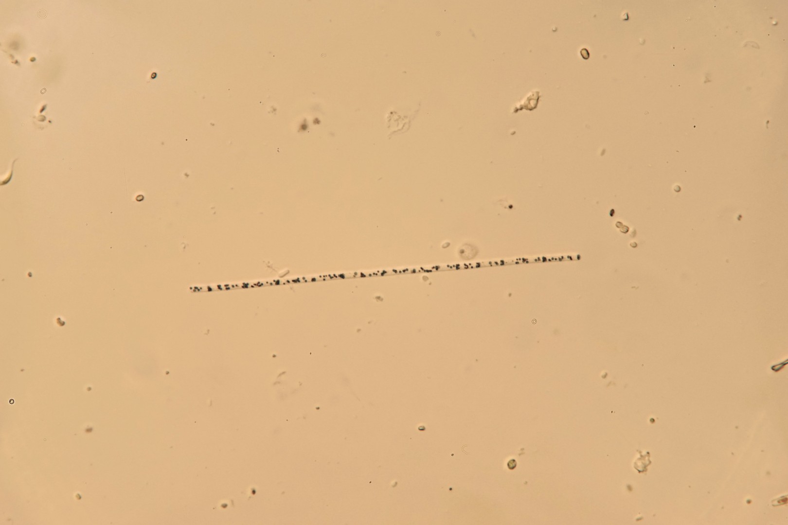Cyanobacteria Beggiatoa