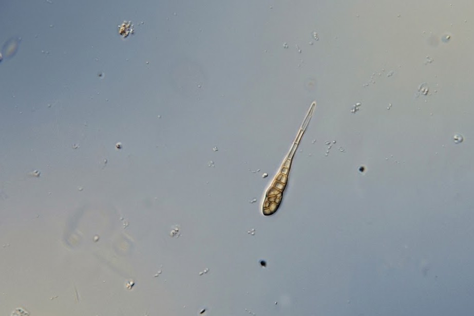 Alternaria spores