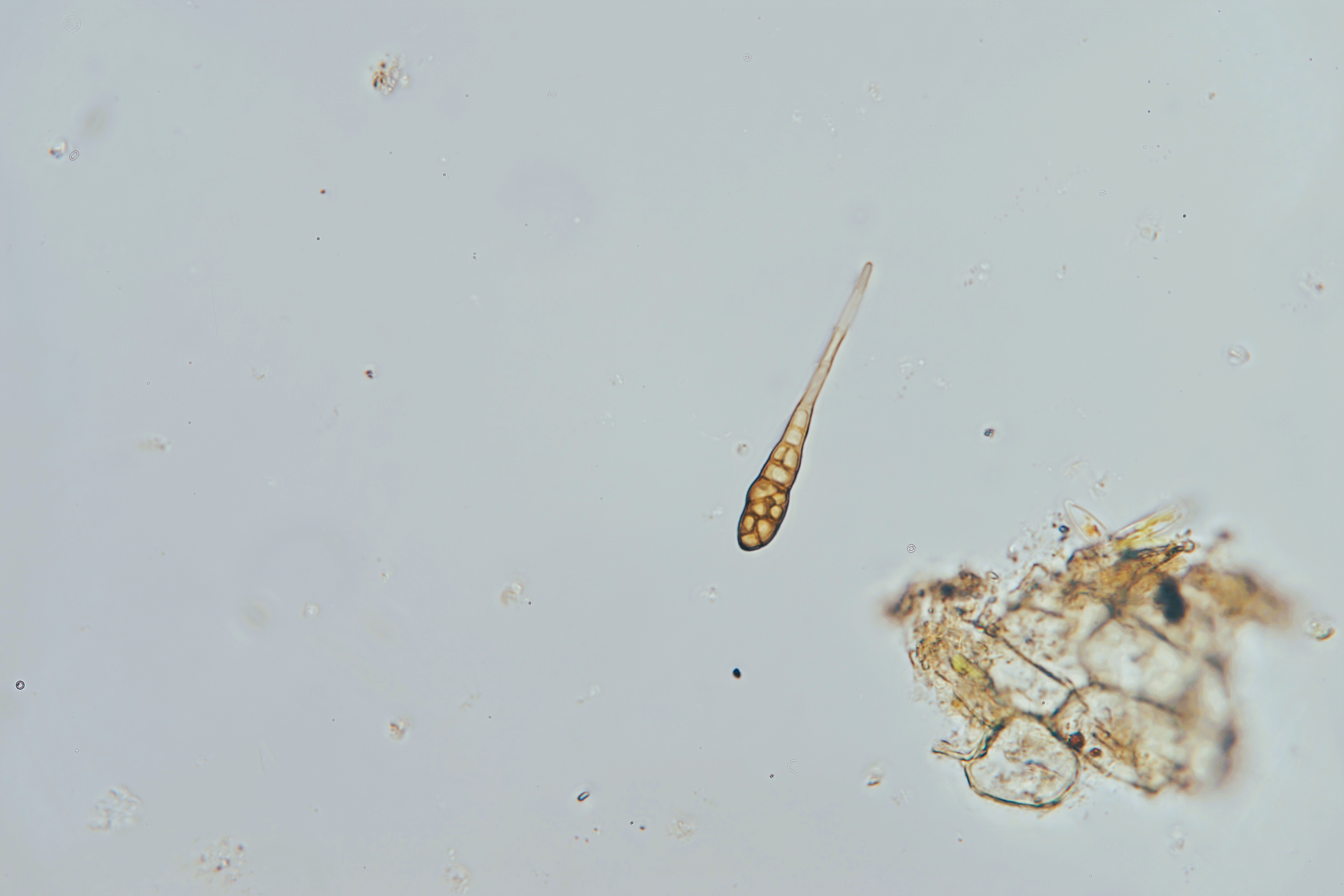Alternaria spores